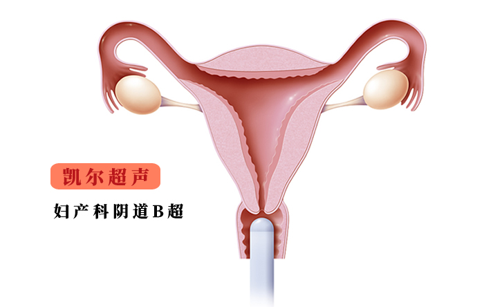 陰道B超,陰道超聲系統(tǒng)